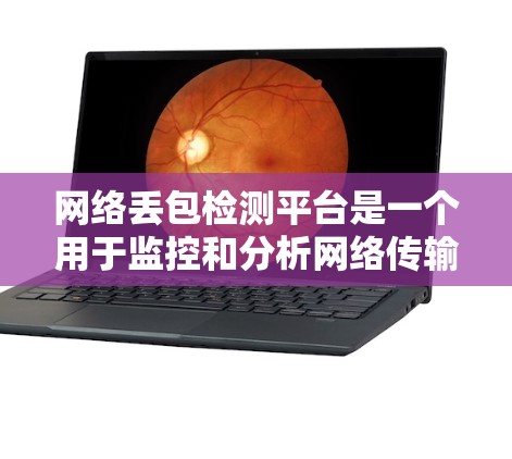 网络丢包检测平台是一个用于监控和分析网络传输过程中数据丢失的工具。以下是对这些平台的详细介绍